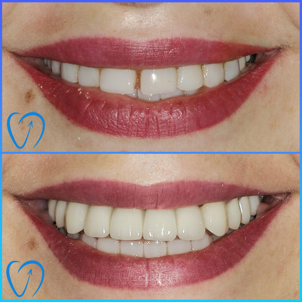 estetica dentara 1.jpg